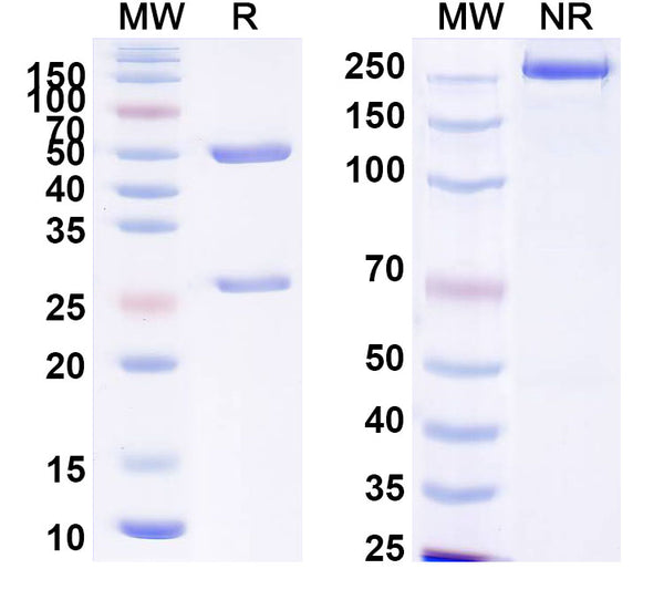 SDS-PAGE for Anti-Human Fibrin Antibody (59D8).