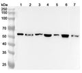 Western blot analysis was performed using anti-FGB  polyclonal antibody at 1ug/mL on various samples.
Lane 1: Mouse heart lysate
Lane 2: Mouse kidney lysate
Lane 3: Mouse brain lysate
Lane 4: Mouse  liver lysate
Lane 5: Rat heart lysate
Lane 6: Rat kidney lysate
Lane 7: Rat liver lysate