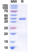 Recombinant Human POMC Protein, N-GST & C-His