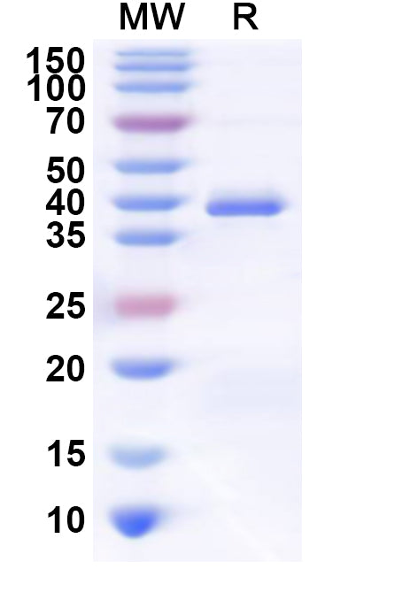 Recombinant Human POMC Protein, N-GST & C-His