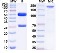 SDS-PAGE for Anti-Human FLNB/Filamin-B Antibody (5H7)