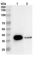 Western blot analysis was performed using anti-OTC polyclonal antibody at 1ug/mL  on various samples.
Lane 1: Mouse liver lysate
Lane 2: Mouse colon lysate