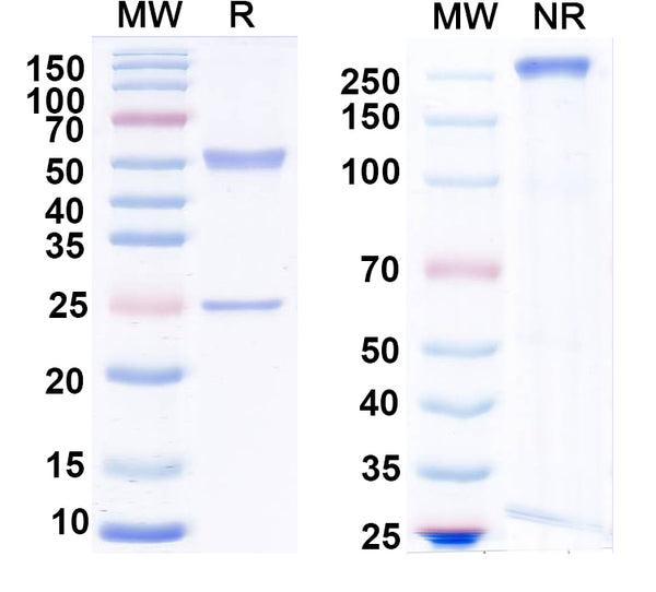 SDS-PAGE for Anti-JMJD2A Antibody (N154/32)