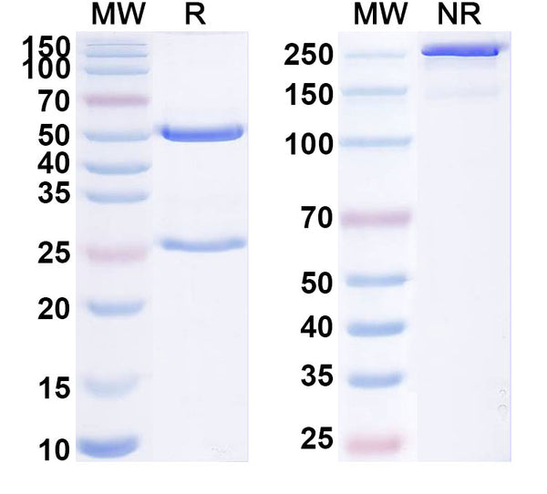 SDS-PAGE for Anti-Human LH Monoclonal Antibody (1A366)