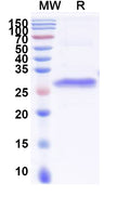 Recombinant Human COL1A1 Protein, N-His