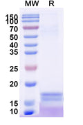 SDS-PAGE for Anti-Human CRP Nanobody (SAA2074).