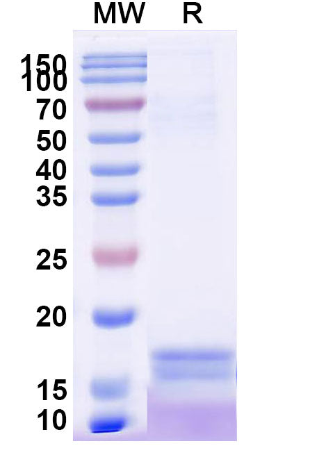 SDS-PAGE for Anti-Human CRP Nanobody (SAA2074).