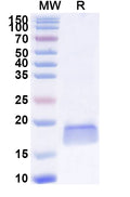 SDS-PAGE for Anti-Human SOD1 Nanobody (SAA1203)