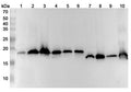 Western blot analysis was performed using anti-SOD1 polyclonal antibody at 1ug/mL  on various samples.
Lane 1: Hela cell lysate
Lane 2: 293T cell lysate
Lane 3: Jurkat cell lysate
Lane 4: K562 cell lysate
Lane 5: HepG2 cell lysate
Lane 6: MCF-7 cell lysate
Lane 7: Mouse brain lysate
Lane 8: Mouse liver lysate
Lane 9: Rat brain lysate
Lane 10: Rat liver lysate