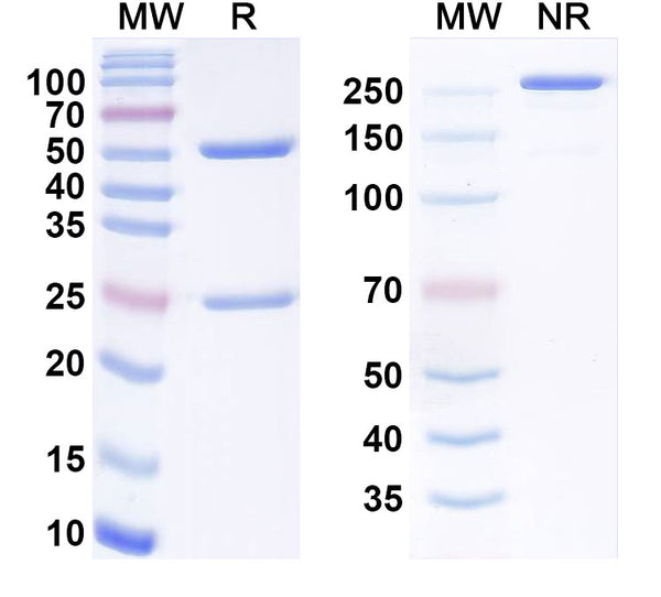 SDS-PAGE for Anti-Human ITGBL1 Monoclonal Antibody (1A070)