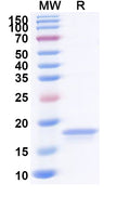 Recombinant Human TNFa/TNF-alpha Protein, N-His