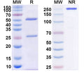 Anti-TNFa/TNF-alpha Reference Antibody (CDP571) – Figure 1 of 1
