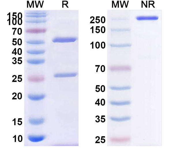 Anti-TNFa/TNF-alpha Reference Antibody (CDP571) – Figure 1 of 1