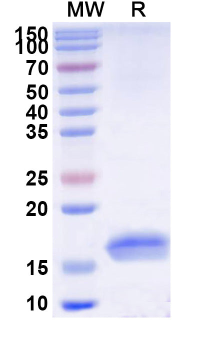 SDS-PAGE for Anti-Human TNFa/TNF-alpha Nanobody (SAA1201)