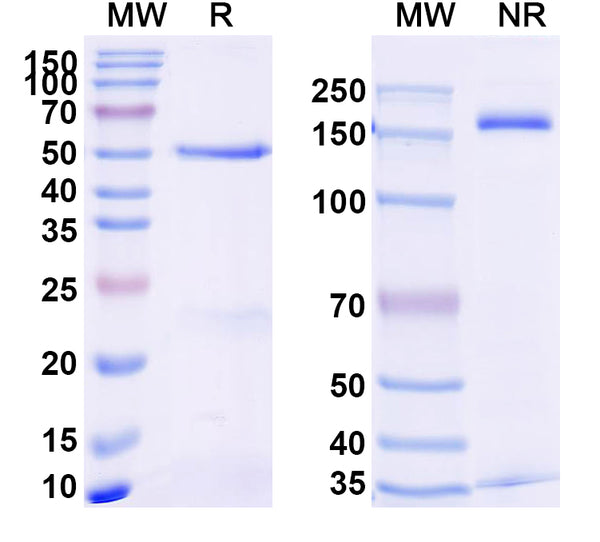 SDS-PAGE for Anti-Human TNFa/TNF-alpha Antibody (SAA2233)