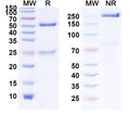 Anti-Human TNF-alpha Reference Antibody (Nerelimomab) – Figure 1 of 2