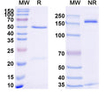 SDS-PAGE for Anti-Human TNFa/TNF-alpha Antibody (SAA2234)