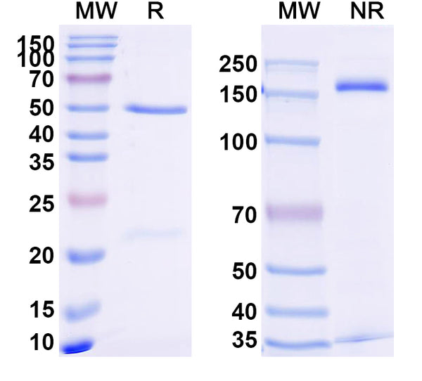 SDS-PAGE for Anti-Human TNFa/TNF-alpha Antibody (SAA2234)