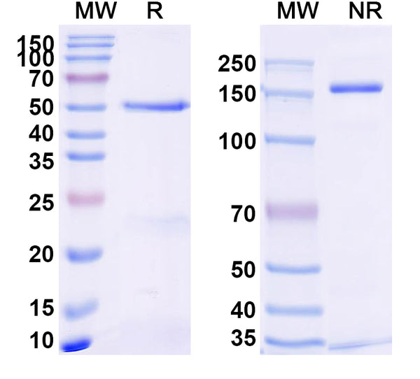 SDS-PAGE for Anti-Human TNFa/TNF-alpha Antibody (SAA2235)