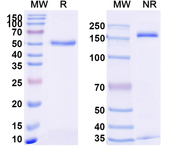 SDS-PAGE for Anti-Human TNFa/TNF-alpha Antibody (SAA2236)