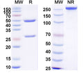 SDS-PAGE for Anti-Human LAYN/Layilin Antibody (SAA2096).