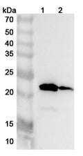 Western blot analysis was performed using anti-TNNC2 polyclonal antibody at 1ug/mL on various samples.
Lane 1: Mouse skeletal muscle lysate
Lane 2: Rat skeletal muscle lysate