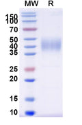 Recombinant Human CD16b/FCGR3B Protein, C-His
