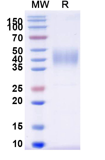 Recombinant Human CD16b/FCGR3B Protein, C-His