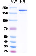 SDS-PAGE for Anti-Human FSHB Antibody (SAA1474).
