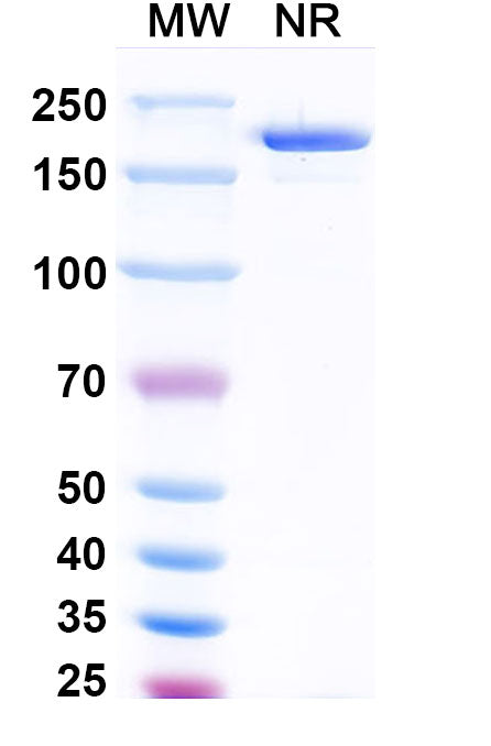 SDS-PAGE for Anti-Human FSHB Antibody (SAA1474).