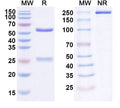 Anti-Human beta-NGF Reference Antibody (Fasinumab) – Figure 1 of 1