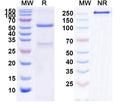 Anti-Human beta-NGF Reference Antibody (Fulranumab) – Figure 1 of 1