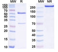 SDS-PAGE for Anti-Human SPINK1 Antibody (SAA1736)