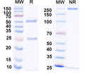 SDS-PAGE for InVivoMAb Anti-Human F9/Factor IX Antibody (10C12)