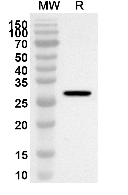 Western blot analysis was performed using anti-F9 polyclonal antibody at 1ug/mL on recombinant F9 (Catalog No. HF916012).