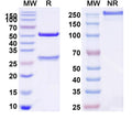 SDS-PAGE for Anti-Human PTH Monoclonal Antibody (1A091)
