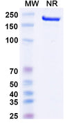 Anti-Human IL-1 beta/IL-1F2 Reference Antibody (Canakinumab) – Figure 1 of 3