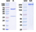 Anti-Human IL-1 beta/IL-1F2 Reference Antibody (Abdakibart) – Figure 1 of 1