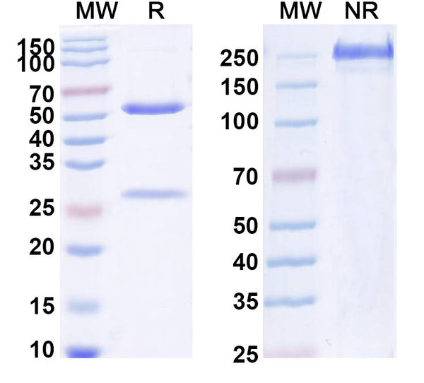 Anti-Human IL-1 beta/IL-1F2 Reference Antibody (Abdakibart) – Figure 1 of 1