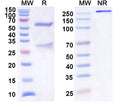 Anti-Human IL-1 beta/IL-1F2 Reference Antibody (Anflekitug) – Figure 1 of 1