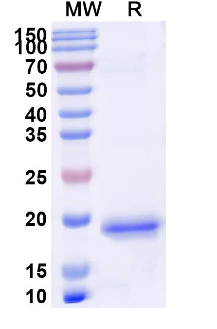 SDS-PAGE for Anti-Human PIGR Nanobody (SAA1311)