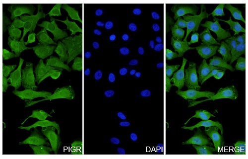 Hela cells were fixed with 4% paraformaldehyde for 20 minutes, followed by blocking with 5% goat serum for 1 hour. The cells were then incubated with a primary antibody targeting PIGR (HF948014) at a concentration of 16 ug/ml overnight at 4°C. Afterward, the cells were incubated with a secondary antibody, Goat Anti-Rabbit IgG (Alexa Fluor-488) for 50 minutes at room temperature. The localization of PIGR was visualized (shown in green), and nuclear DNA was stained with DAPI (shown in blue).