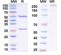 SDS-PAGE for Anti-Human NPY/PYY Antibody (5E12#)