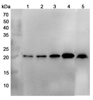 Western blot analysis was performed using anti-DNDUFB10 polyclonal antibody at 1μg/ml on various samples.
Lane 1: Hela cell lysate
Lane 2: MCF-7 cell  lysate
Lane 3: 293T cell lysate
Lane 4: A549 cell lysate
Lane 5: Mouse heart lysate