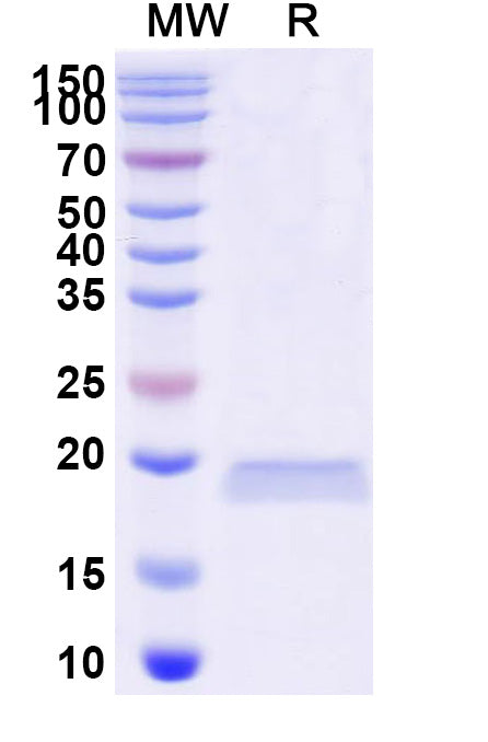 SDS-PAGE for Anti-Human LRP6 Nanobody (SAA0903)