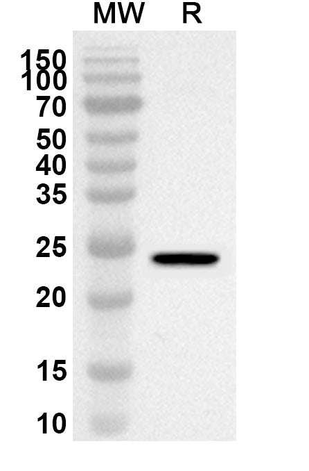 Western blot analysis was performed using anti-ADCY5 polyclonal antibody at 1ug/mL on recombinant ADCY5 (Catalog No. HF975022).