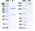 SDS-PAGE for Anti-Human CCN4/WISP-1 Antibody (SAA1975)