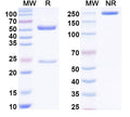 SDS-PAGE for Anti-Human F8/Coagulation factor VIII Antibody (SAA0541).