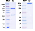 SDS-PAGE for InVivoMAb Anti-F8/Coagulation factor VIII Antibody (KM33).