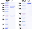 SEC-HPLC detection for Anti-Human F8/Coagulation factor VIII Antibody (ABS1683).